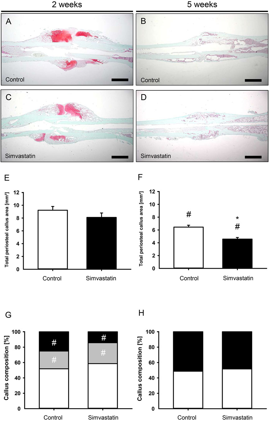 Histological images and graphs comparing control and simvastatin treatments at two and five weeks. Panels A and C show histological slides at two weeks, while panels B and D show slides at five weeks, with noticeable differences in staining. Panels E and F present bar graphs of total periosteal callus area at two and five weeks, respectively. Panels G and H are stacked bar graphs showing callus composition perventages. Differences between treatments are indicated by symbols.