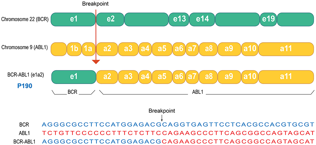 Diagram showing the gene fusion in rhabdomyosarcoma. Chromosome 22 (BCR) and Chromosome 9 (ABL1) are depicted with specific gene segments. A breakpoint leads to the fusion of BCR-ABL1 (e1a2) with labeled sections BCR and ABL1. The P190 is underlined in blue. Below, a DNA sequence comparison at the fusion breakpoint is shown, with BCR, ABL1, and BCR-ABL1 sequences.