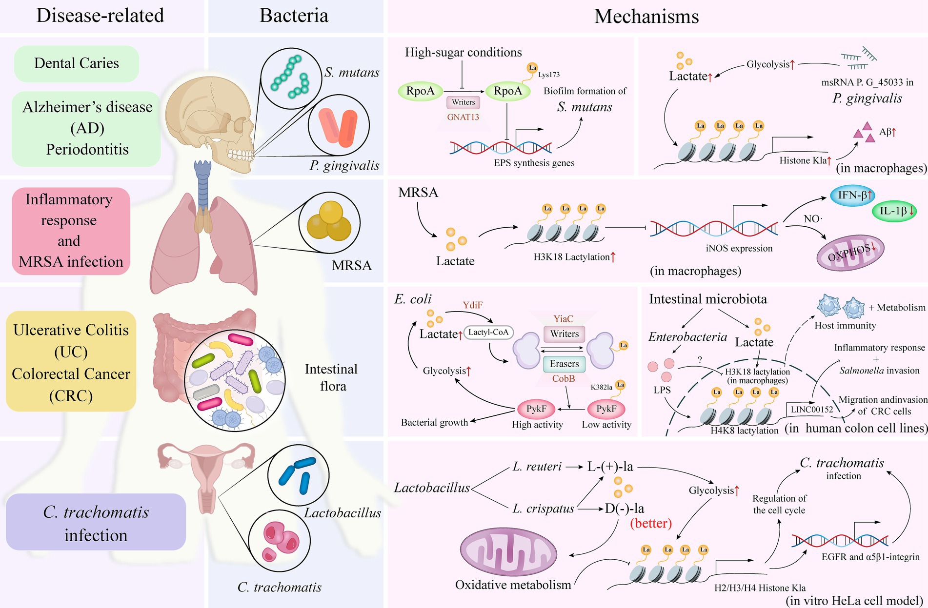 Diagram illustrating relationships between diseases, bacteria, and mechanisms. Diseases like dental caries, Alzheimer's, periodontitis relate to *S. mutans* and *P. gingivalis*. Inflammatory responses and MRSA involve MRSA bacteria. Ulcerative colitis and colorectal cancer connect to intestinal flora. *C. trachomatis* infection involves *Lactobacillus* and *C. trachomatis*. Mechanisms detail processes like biofilm formation, lactylation in macrophages, glycolysis, and oxidative metabolism, with diagrams illustrating specific bacterial processes and interactions with human cells.