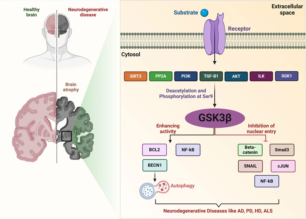Illustration comparing a healthy brain with one affected by neurodegenerative disease, highlighting brain atrophy. The right panel depicts a molecular pathway involving GSK3β. It shows deacetylation and phosphorylation at Ser9, with substrates like SIRT3, PP2A, and others involved in enhancing activity and inhibiting nuclear entry. Pathways link to processes like autophagy and nuclear protein entry, associated with neurodegenerative diseases such as Alzheimer's and Parkinson's.