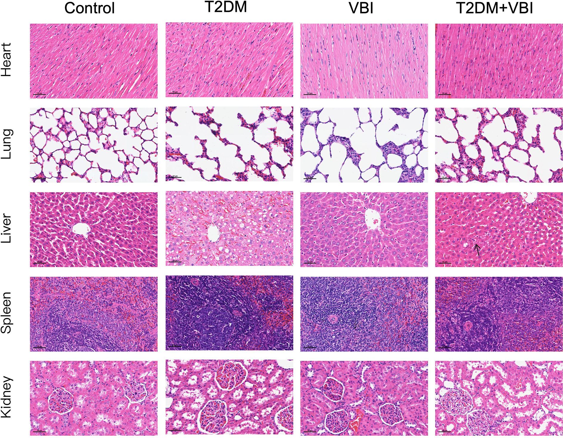 Histological images of heart, lung, liver, spleen, and kidney tissues across four groups: Control, T2DM, VBI, and T2DM+VBI. Each row represents a different organ, while each column represents a different treatment condition, showing varying tissue structures and staining patterns.