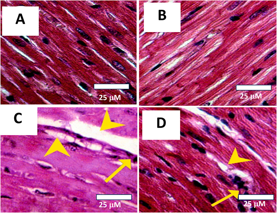 Four panel microscopic images labeled A, B, C, and D showing cardiac muscle tissue. Panels A and B display healthy muscle fibers with uniform striations and nuclei. Panels C and D highlight disrupted areas with yellow arrows and triangles pointing to damaged fibers and gaps. Scale bars indicate 25 micrometers.