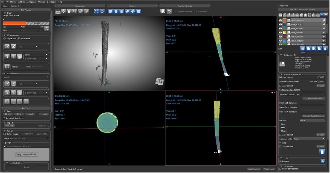 Dental imaging software interface displaying a 3D model of a root canal. The screen is divided into four sections, showing different views of the scanned object. The left panel includes tools for segmentation and visualization. The right panel lists data properties and settings. Measurements and properties are displayed in each section, with a focus on analyzing and visualizing dental structures.