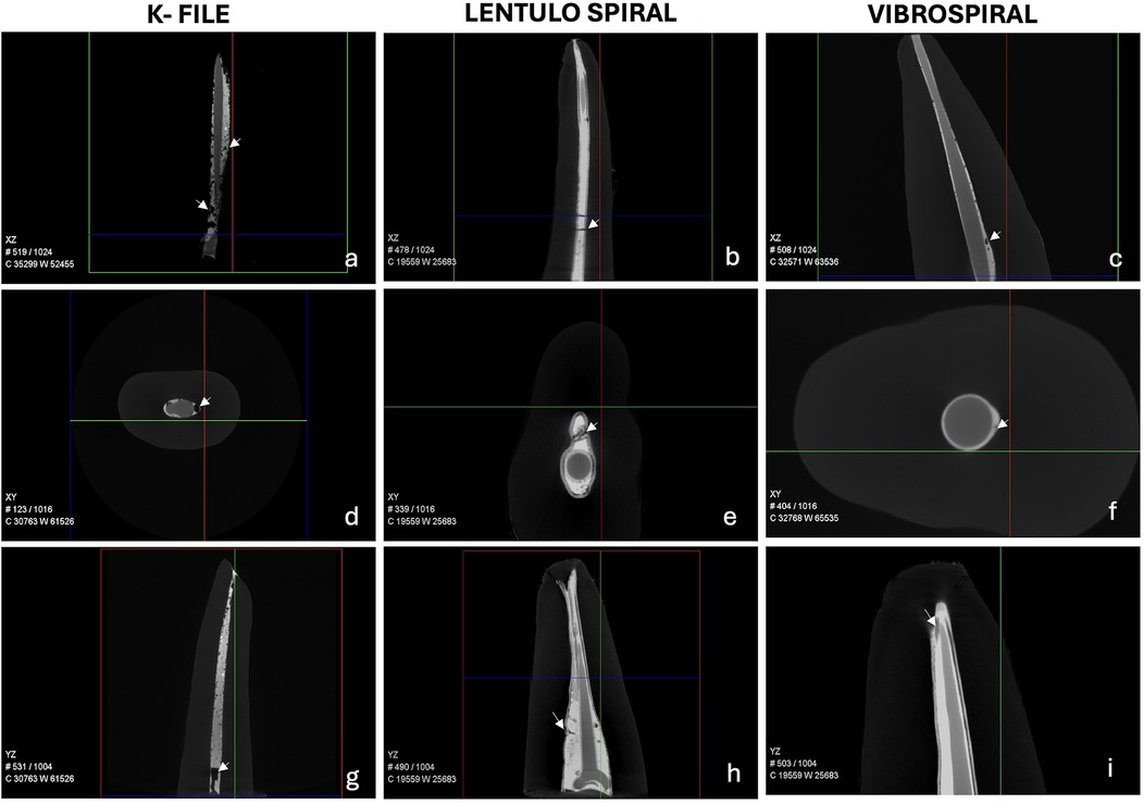 Three rows of X-ray images show root canals in different orientations: K-File (a, d, g), Lentulo Spiral (b, e, h), and VibroSpiral (c, f, i). Each column illustrates different views (XZ, XY, YZ) highlighting structural differences and positions. Arrows indicate specific areas of interest.