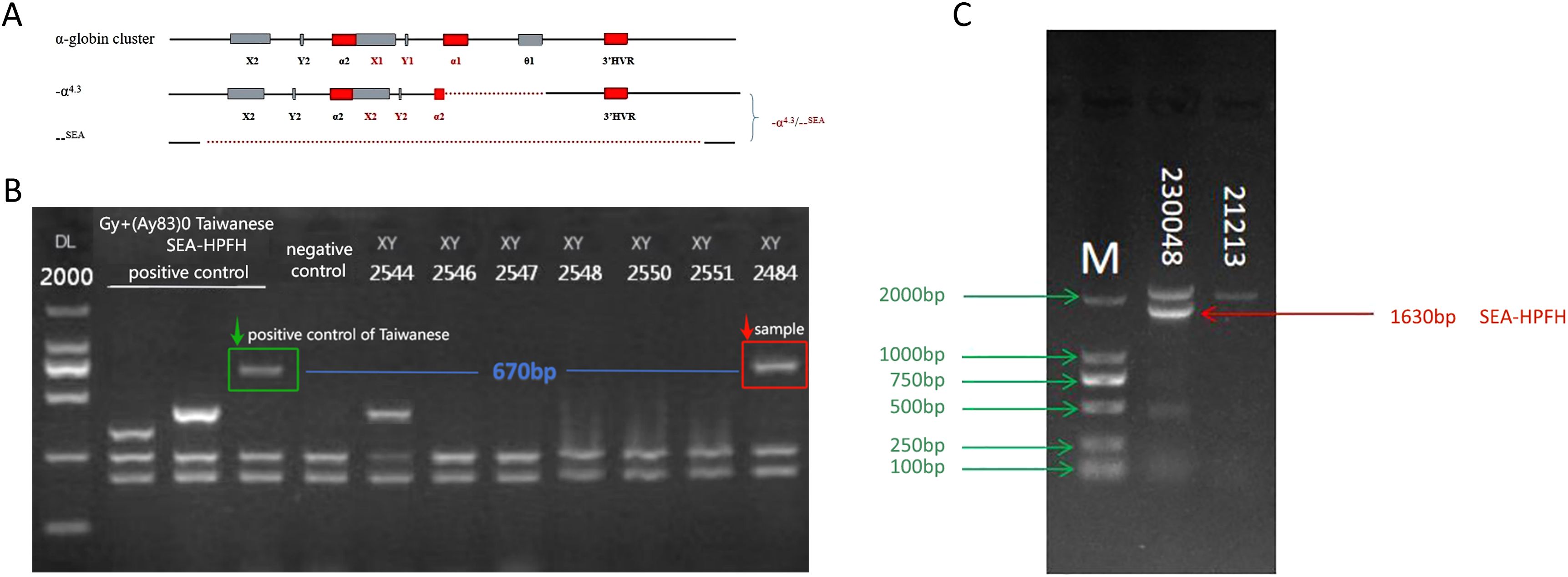 Diagram showing the structure of the alpha-globin gene cluster, with specific segments marked. Gel electrophoresis results display DNA bands, labeled for positive and negative controls, and a sample. Band sizes in base pairs are indicated, with prominent bands at 670 and 1630 base pairs highlighted.