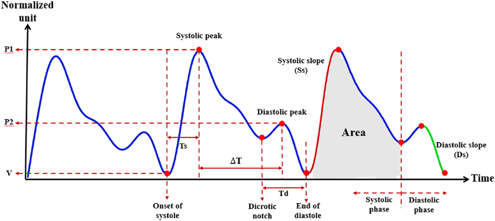 Graph showing a cardiovascular waveform with labeled peaks and phases. The horizontal axis represents time, and the vertical axis is in normalized units. Features include systolic and diastolic peaks, onset of systole, dicrotic notch, and end of diastole. Phases are marked as systolic and diastolic with measured slopes (Ss and Ds) and areas indicated.