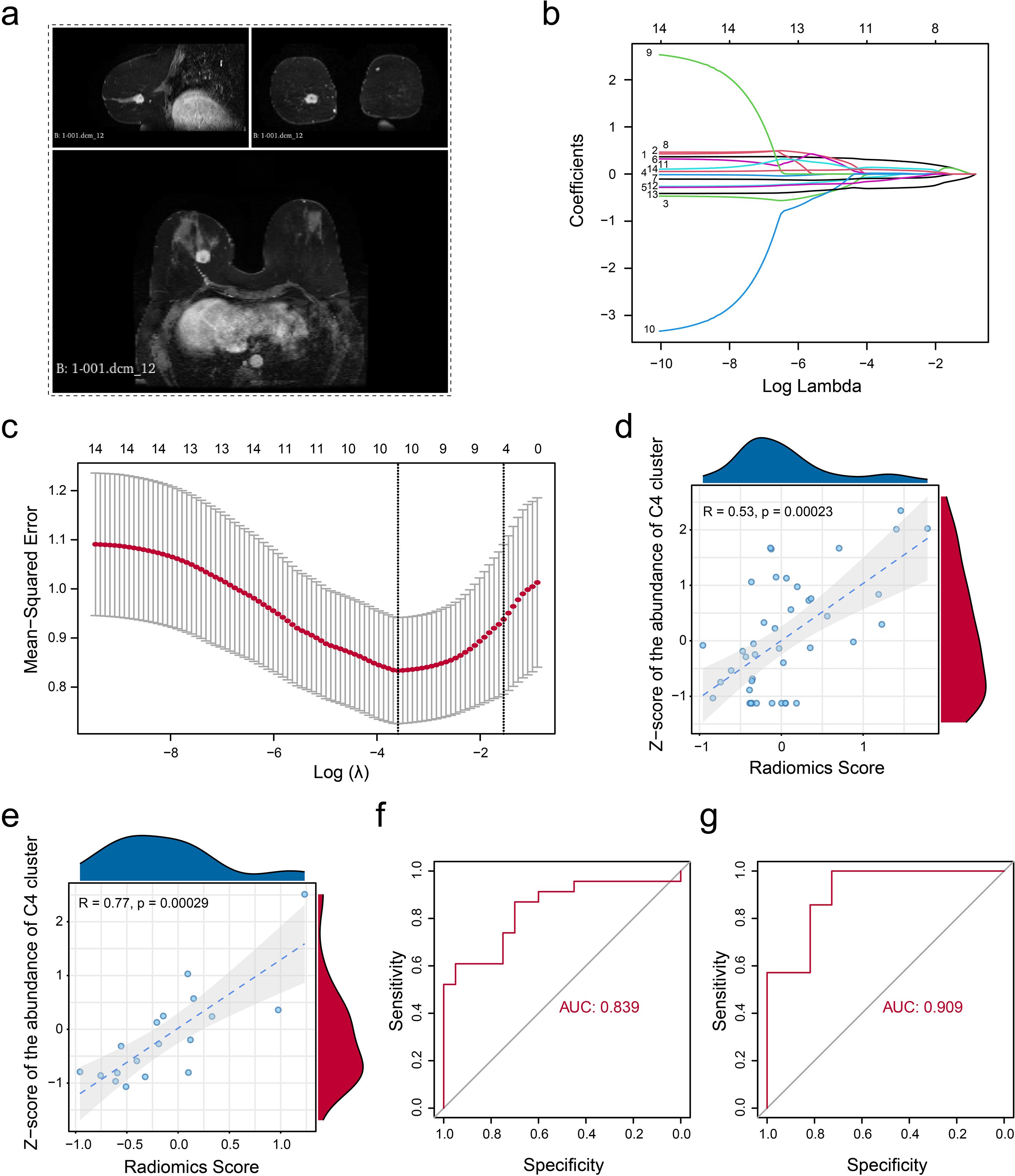 MRI images, graphs, and data visualizations are shown. Image (a) displays MRI scans. Graph (b) shows coefficient paths versus log lambda. Graph (c) illustrates mean squared error versus log λ. Scatter plots (d) and (e) depict the correlation between radiomics scores and Z-scores of C4 cluster abundance, with associated histograms. Graphs (f) and (g) are ROC curves with AUC values of 0.839 and 0.909, demonstrating model performance.