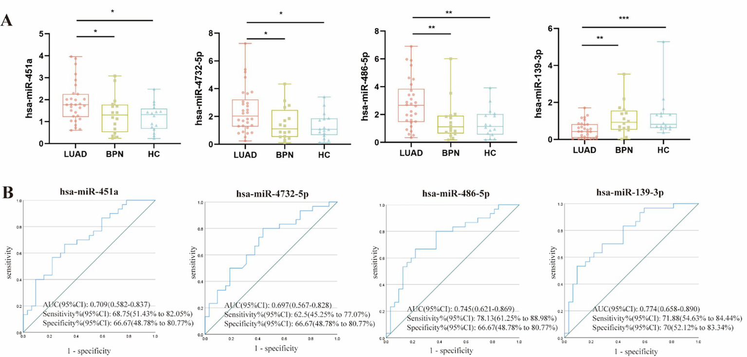 Box plots and ROC curves detail the expression and diagnostic performance of four miRNAs (hsa-miR-451a, hsa-miR-4732-5p, hsa-miR-486-5p, hsa-miR-139-3p) across different sample groups (LUAD, BPN, HC). Box plots show expression levels, with significant differences indicated by asterisks. ROC curves display sensitivity, specificity, and AUC values for each miRNA, illustrating their diagnostic accuracy.