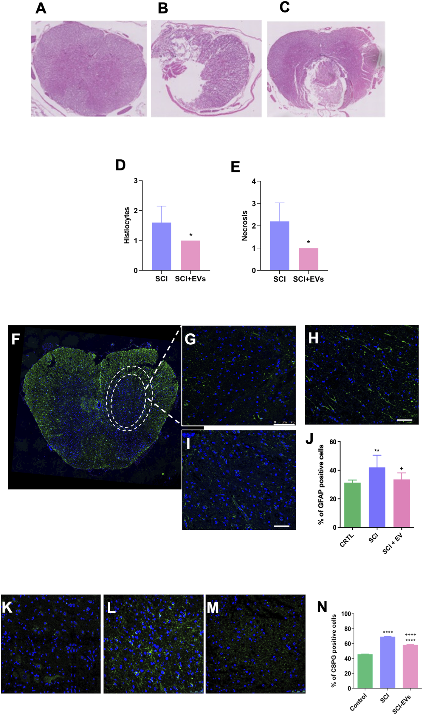 Histological images A-C show tissue structures with differing levels of damage. Bar graphs D and E display data comparing histiocyte counts and necrosis between SCI and SCI+EVs groups. Immunofluorescence images F-I and K-M reveal cellular details, with J and N presenting bar graphs indicating percentages of GFAP and CSPG positive cells under different conditions (CTRL, SCI, SCI+EV).