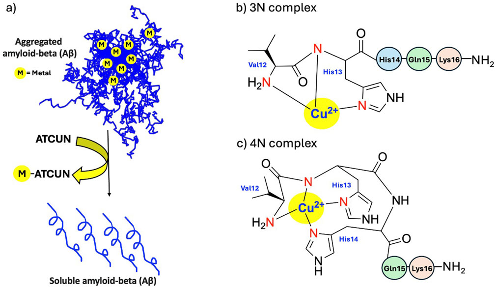 Diagram illustrating the interaction and transformation of amyloid-beta (Aβ) with metal ions. Panel a shows the aggregation of Aβ with metals labeled as