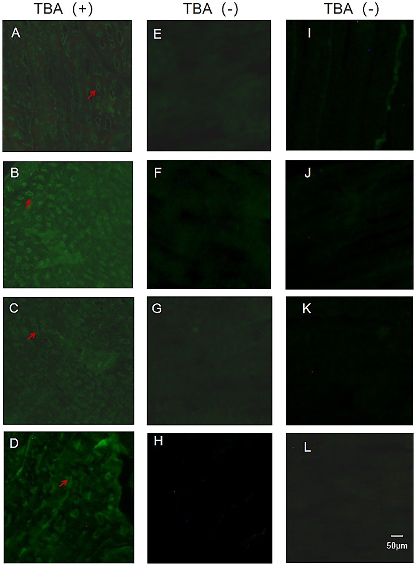 Microscopic images of tissue samples arranged in a grid. Panels A-D show TBA positive samples with green fluorescence and red arrows indicating specific areas. Panels E-H and I-L display TBA negative samples with dimmer fluorescence. A scale bar of 50 micrometers is included in panel L.