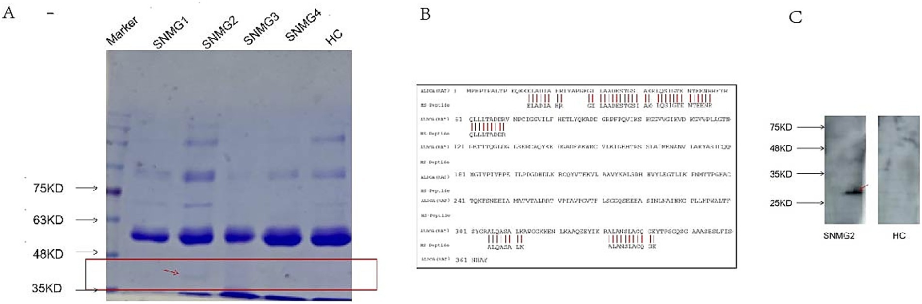 Gel electrophoresis and protein sequence analysis. Panel A shows a protein gel with markers labeled from thirty-five to seventy-five kilodaltons, comparing lanes labeled as SNMG1 to SNMG4 and HC. Panel B contains sequences with highlighted sections. Panel C presents two blotted strips labeled SNMG2 and HC with molecular weights marked on the left side.