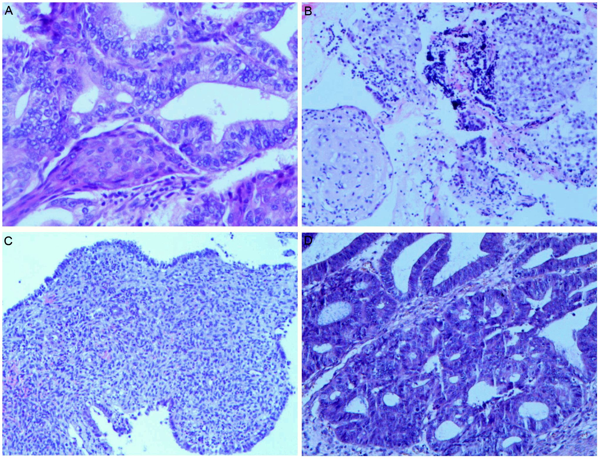 Panel A shows a close-up of epithelial cells with glandular structures. Panel B depicts a view of loosely organized tissue with sparse cellular distribution. Panel C illustrates a dense cluster of small, round cells. Panel D shows glandular formations with closely packed cells and darker staining.