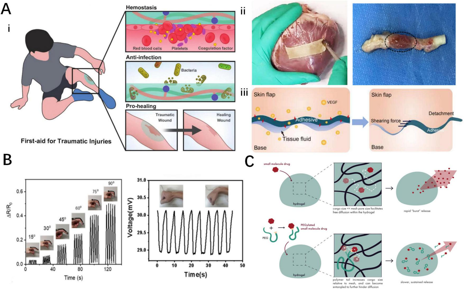 Panel A-i) illustration of first-aid for traumatic injuries with sections on hemostasis, anti-infection, and pro-healing. Photos of surgical procedures with adhesives. ii) illustration of the dressings used for cardiovascular system diseases iii) illustration of detachment process of adhesives for flap transplantation. Panel B demonstrates the voltage changes with the cyclic movement of the wrist. Panel C illustrates drug release mechanisms in hydrogels.