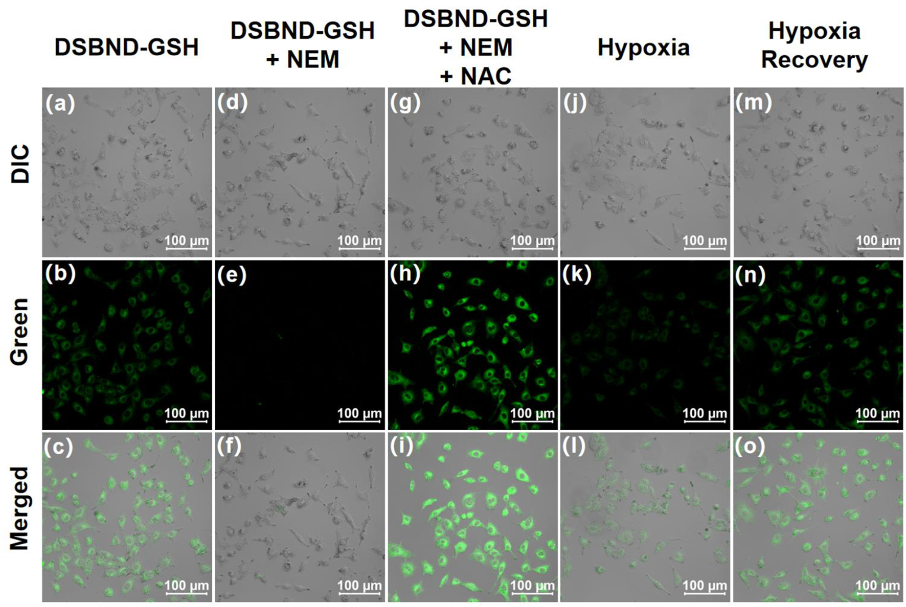 Microscopic images show cells under different conditions. Rows depict DIC, green fluorescence, and merged images. Columns represent treatments: DSBND-GSH, DSBND-GSH + NEM, DSBND-GSH + NEM + NAC, hypoxia, and hypoxia recovery. Each cell group varies in density and fluorescence intensity. Scale bars indicate 100 micrometers.