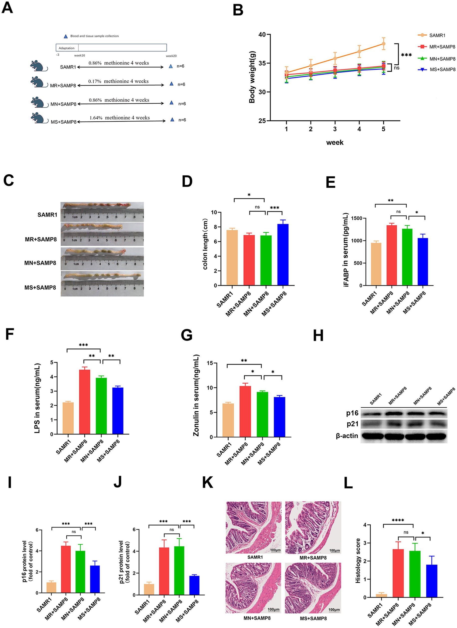 Experimental study results showing various analyses on mice groups, including SAMR1, MR+SAMP8, MN+SAMP8, and MS+SAMP8. Charts (B, D-G, I, J, L) display measurements like body weight, colon length, serum levels of iFABP, LPS, and Zonulin, and protein levels with significant differences marked. Images (C, K) reveal colon tissues and histological changes. A protein expression analysis is shown in panel H.