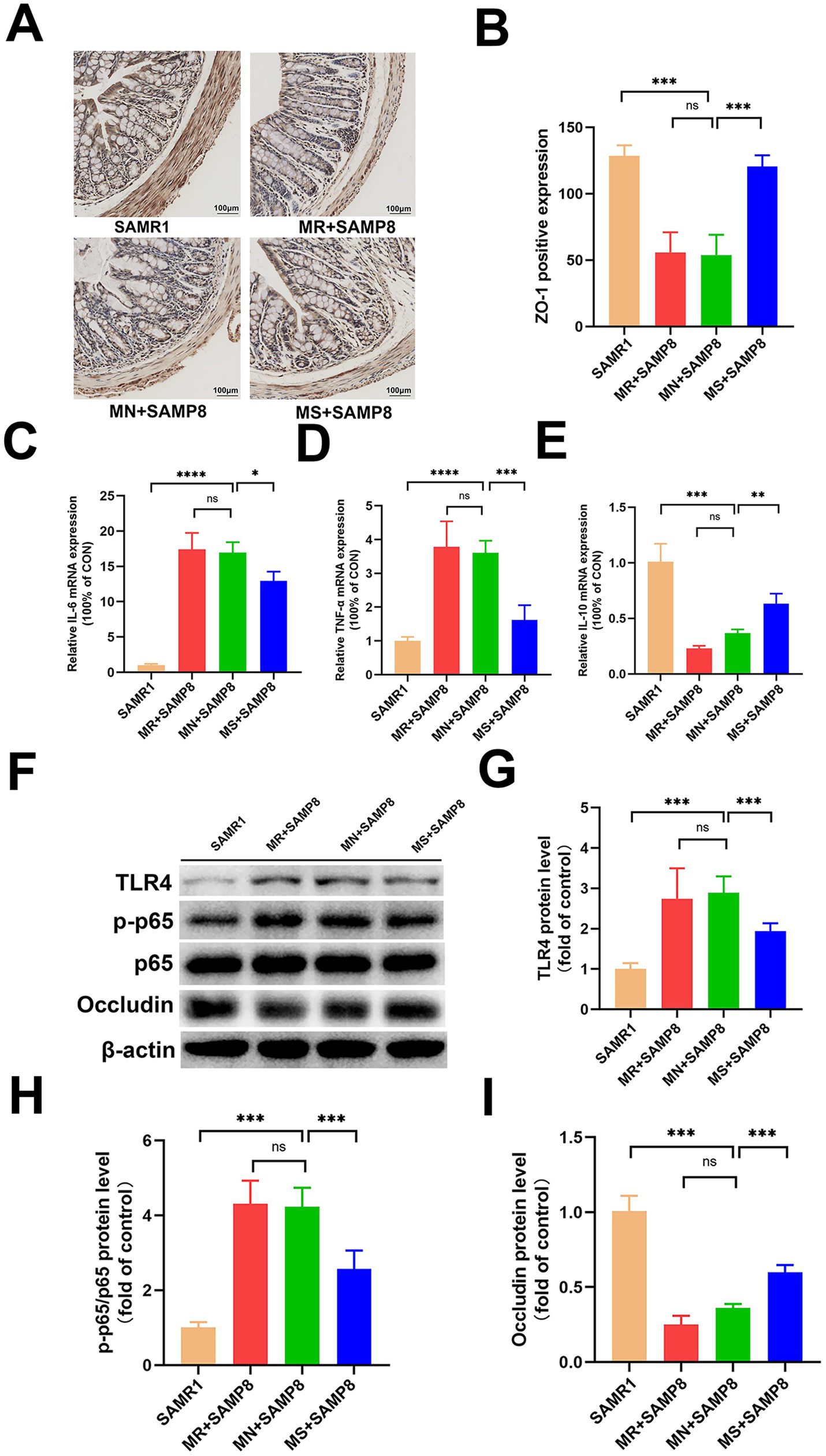 Panel A shows histological images of intestinal tissue sections from four groups: SAMR1, MR+SAMP8, MN+SAMP8, and MS+SAMP8. Panel B is a bar graph of ZO-1 positive expression. Panel C shows relative IL-6 mRNA expression, while Panel D displays TNF-a mRNA expression. Panel E illustrates IL-10 mRNA expression. Panel F presents a Western blot analysis for TLR4, p-p65, p65, occludin, and β-actin. Panel G shows TLR4 protein levels, Panel H displays p-p65/p65 protein levels, and Panel I shows occludin protein levels. Statistical significance is indicated with asterisks.
