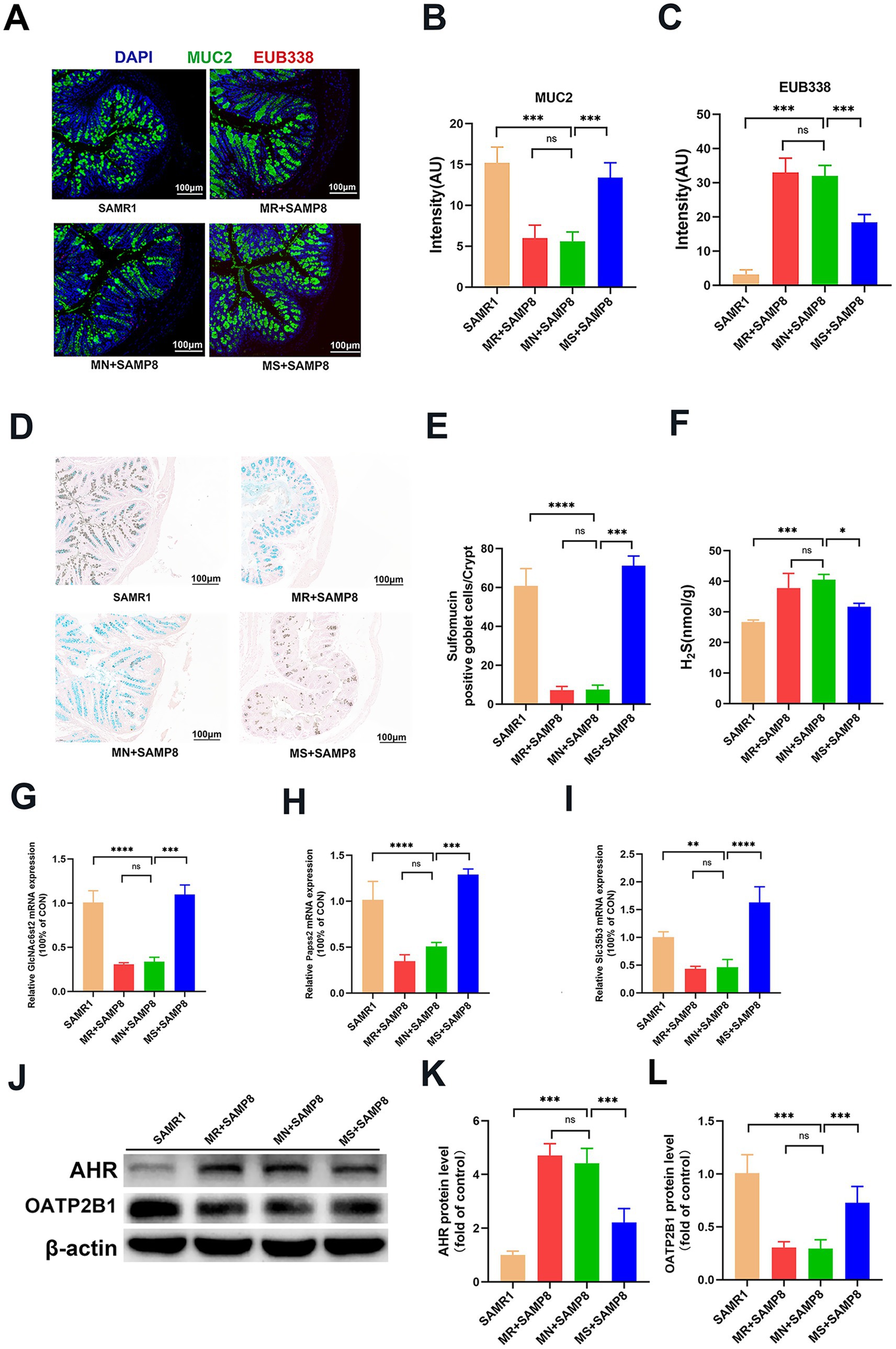 Effects of dietary methionine level on MUC2 and EUB338 probe fluorescence intensity in colonictissue (Panel A). Bar charts (Panels B, C, E, F, G, H, I, K, L) depict quantification of MUC2 and EUB338 intensities, sulfomucin-positive goblet cells, H2S levels, and gene and protein expressions. Significant differences are marked by asterisks. Panel D shows histological staining of sulfomucin in intestinal crypts. Panel J displays Western blot results of AHR, OATP2B1, and β-actin expressions across samples. Each image or graph corresponds to different experimental conditions involving control and treatment groups.