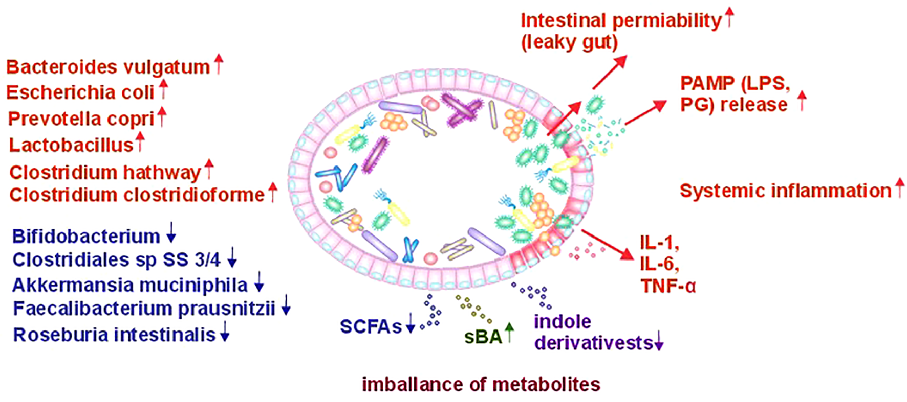 chematic illustrating changes in gut microbiota balance and metabolites, highlighting increased bacteria like Bacteroides vulgatum and decreased bacteria such as Bifidobacterium. This imbalance, shown in the gut, leads to increased intestinal permeability and systemic inflammation through increased PAMP release and cytokines such as IL-1, IL-6, and TNF-a. The image signifies the correlation between gut imbalance and health issues, with arrows indicating changes and effects.