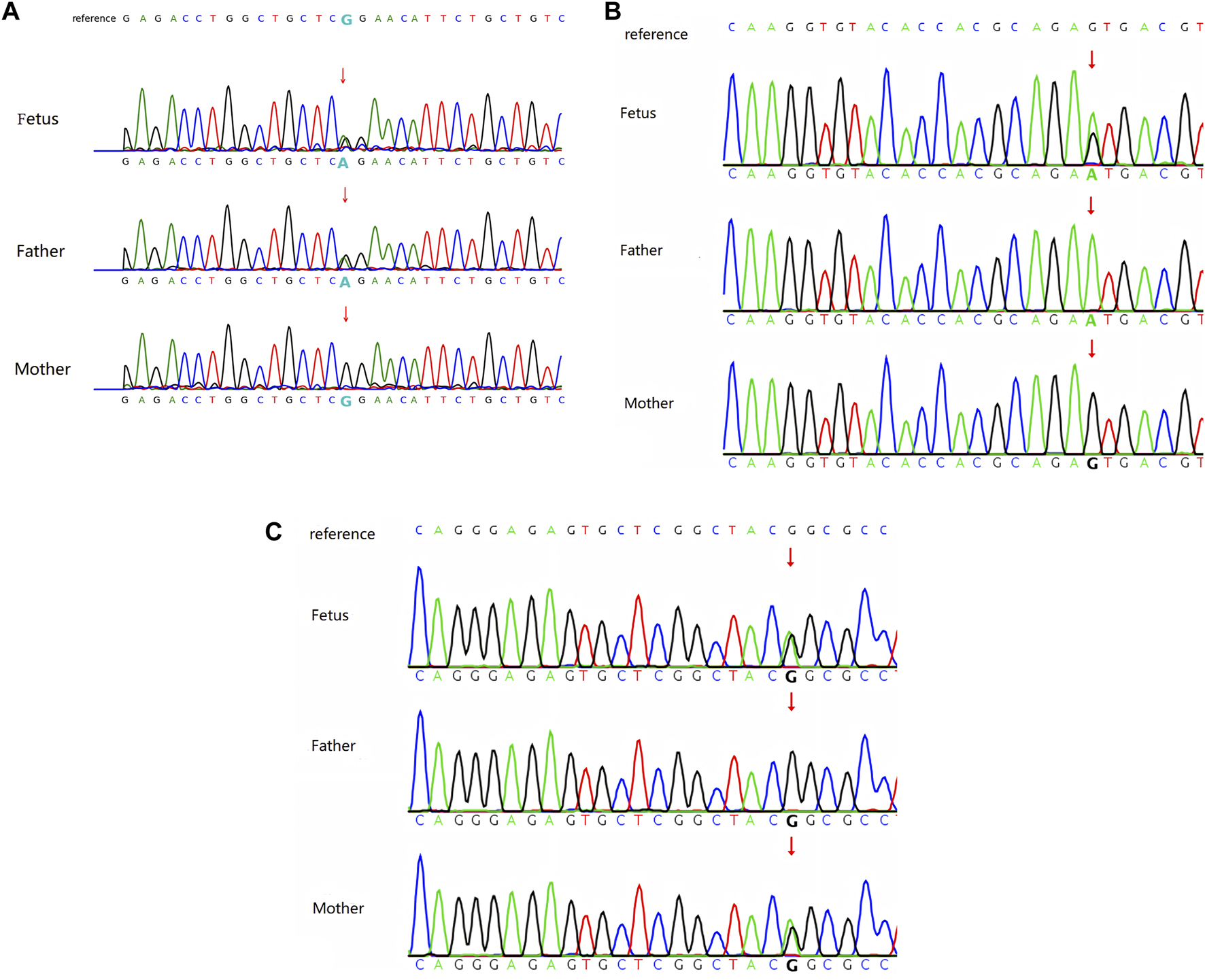 DNA sequencing chromatographs for a fetus, father, and mother are displayed in three panels A, B, and C, each showing genetic variations. Each panel compares the reference sequence to the respective individual’s sequence, highlighting differences such as single nucleotide polymorphisms with arrows. The color-coded peaks represent nucleotides: adenine (green), thymine (red), cytosine (blue), and guanine (black). Arrows pinpoint specific nucleotide changes in the sequences of the fetus, father, and mother.