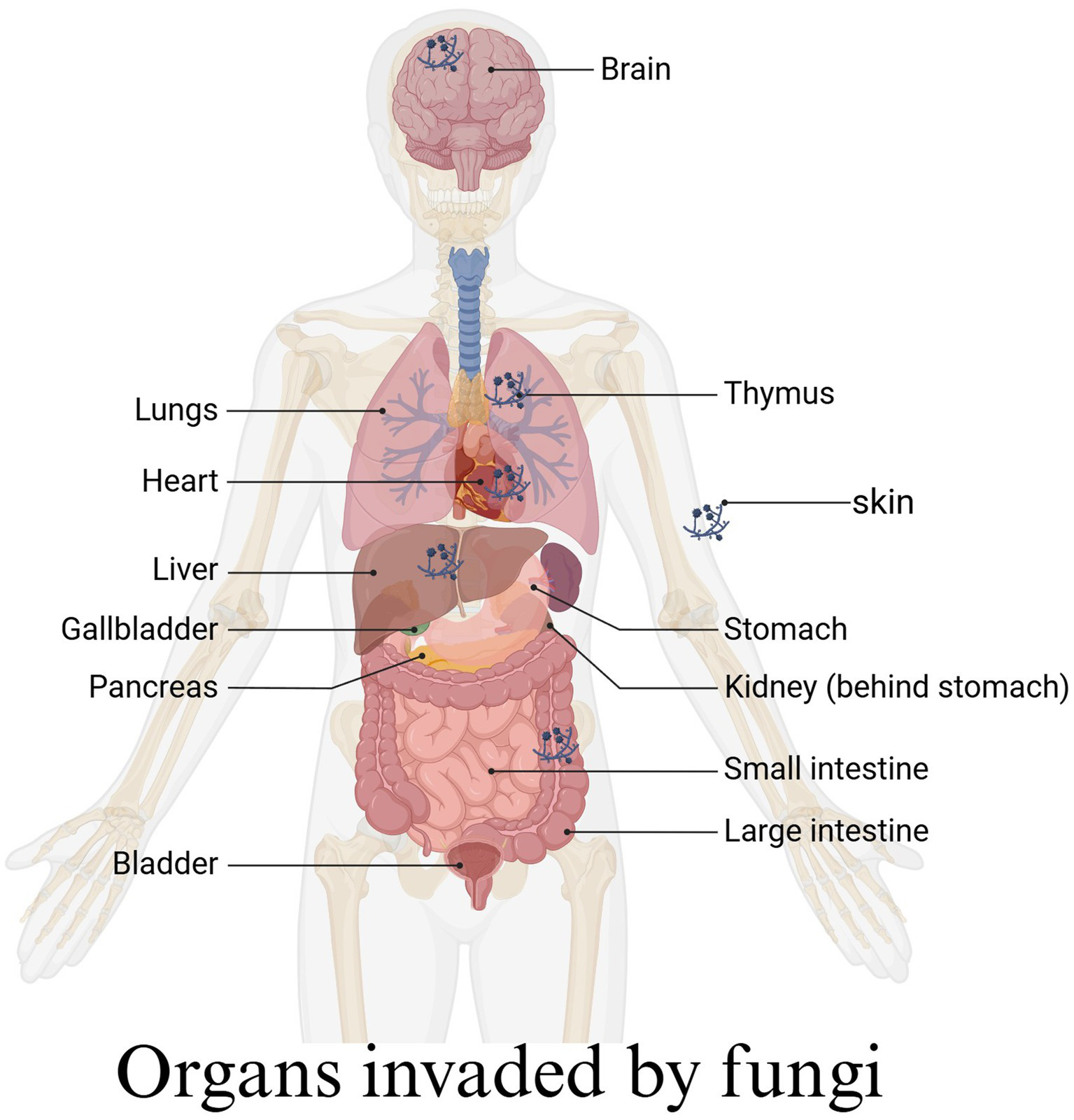 Diagram of a human body illustrating organs invaded by fungi. Labeled organs include the brain, lungs, thymus, heart, skin, liver, gallbladder, pancreas, stomach, kidney, small intestine, large intestine, and bladder, all marked with fungal symbols.