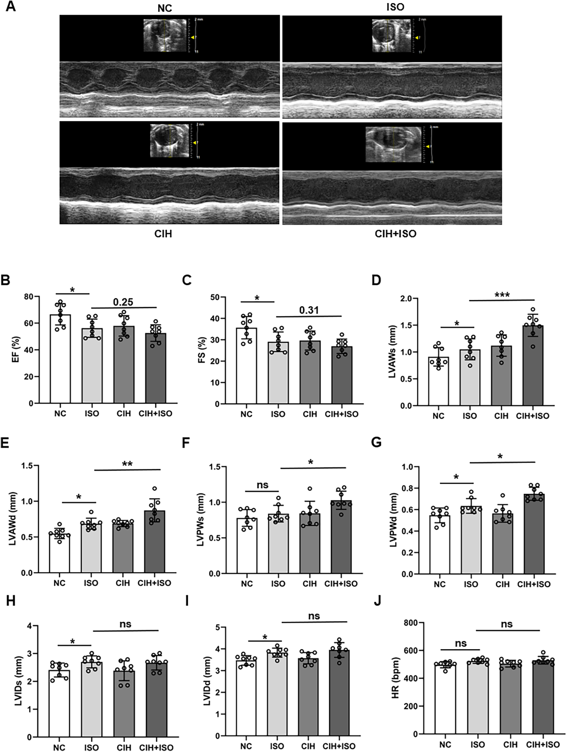 Panel A shows echocardiographic images under different conditions: NC, ISO, CIH, and CIH+ISO. Panels B to J are bar graphs comparing heart function and structure metrics across these groups. Measurements include ejection fraction, fractional shortening, and various left ventricular dimensions. Statistical significance is indicated by asterisks.