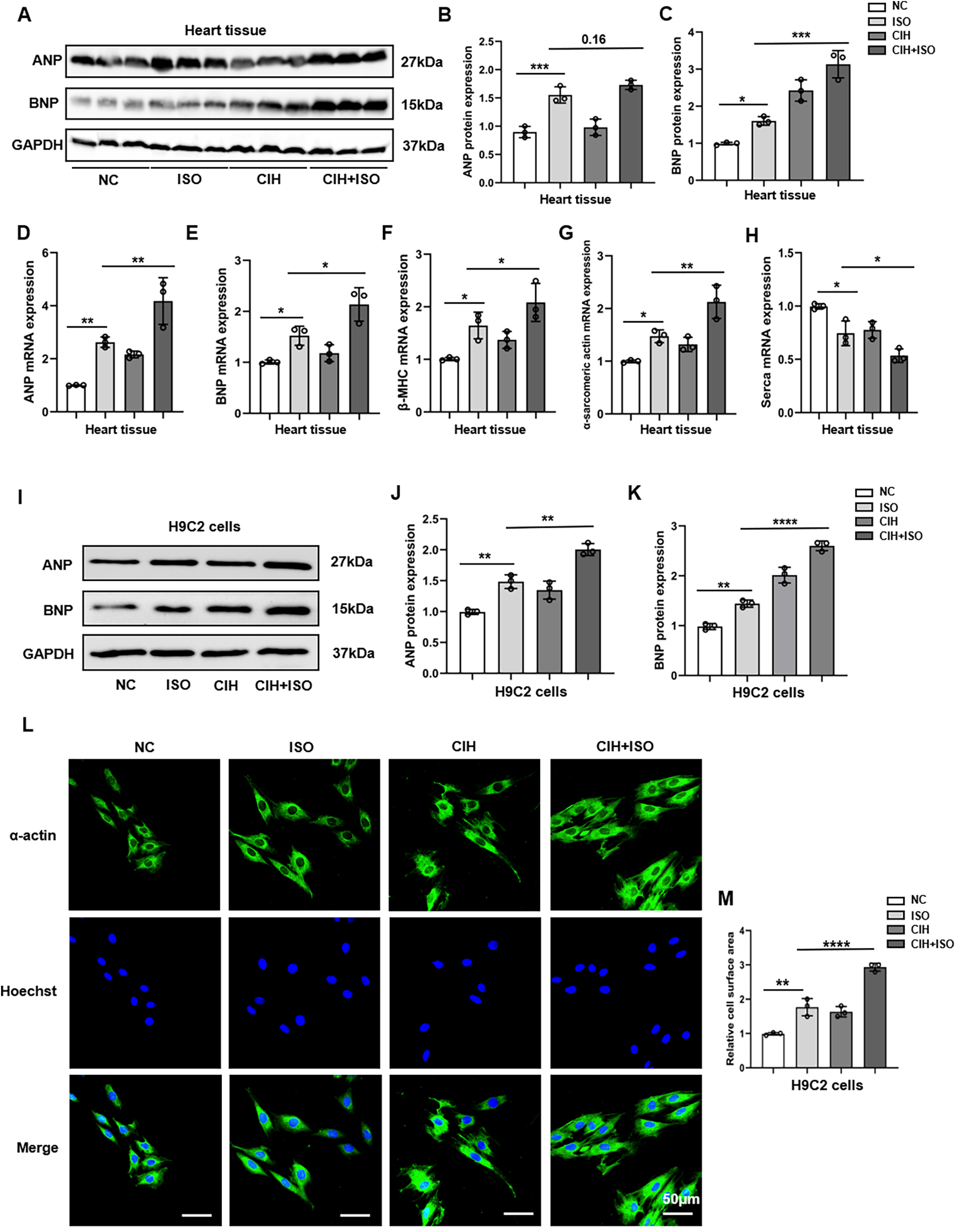 Western blot analysis panels (A, I) and bar graphs (B-H, J-K, M) showing ANP, BNP protein, and mRNA expression in heart tissues and H9C2 cells under different conditions: NC, ISO, CIH, CIH+ISO. Immunofluorescence images (L) depict α-actin, Hoechst staining, and merged views under the same conditions. Statistical significance is indicated with asterisks for comparisons across the conditions.