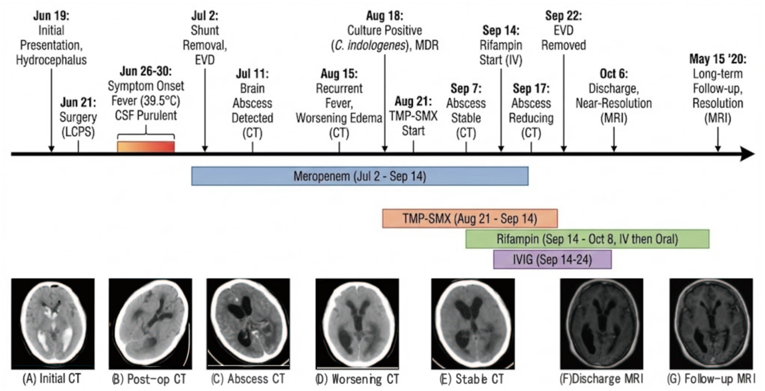Timeline of a medical case involving surgery and treatment for hydrocephalus and brain abscess. Key events include shunt removal, recurrent fever, and various medications. Images A-G show CT and MRI scans from initial presentation through follow-up, illustrating changes in brain condition over time.