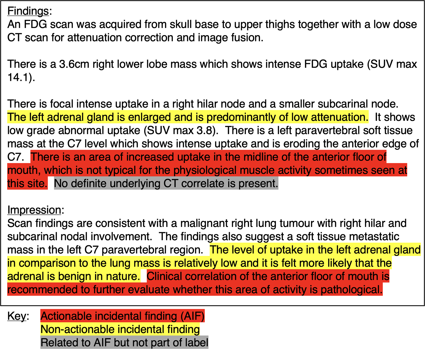 Findings from an FDG scan indicate a 3.6 cm right lower lobe mass with intense FDG uptake. There is focal intense uptake in a right hilar node and a smaller subcarinal node. The left adrenal gland is enlarged with low attenuation. An abnormal uptake in the midline of the anterior floor of the mouth is noted, which is atypical for physiological muscle activity. No definite CT correlate is present. The impression suggests malignant right lung tumor with nodal involvement. Low uptake in the left adrenal gland likely suggests it's benign. Recommendations include further evaluation of the anterior mouth floor activity. Key highlights actionable findings in red, non-actionable in yellow, and related in gray.