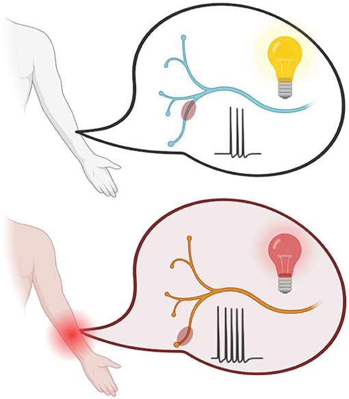Illustration showing two diagrams of a human arm. The top  diagram has a blue nerve bundle with the reddish area (depicting the location of action potential initiation) far away from the nerve ending and a yellow light bulb, indicating normal nerve function. The bottom diagram shows a red inflamed area, an orange nerve bundle, and the reddish area close to the nerve ending, and a red light bulb, indicating enhanced pain.