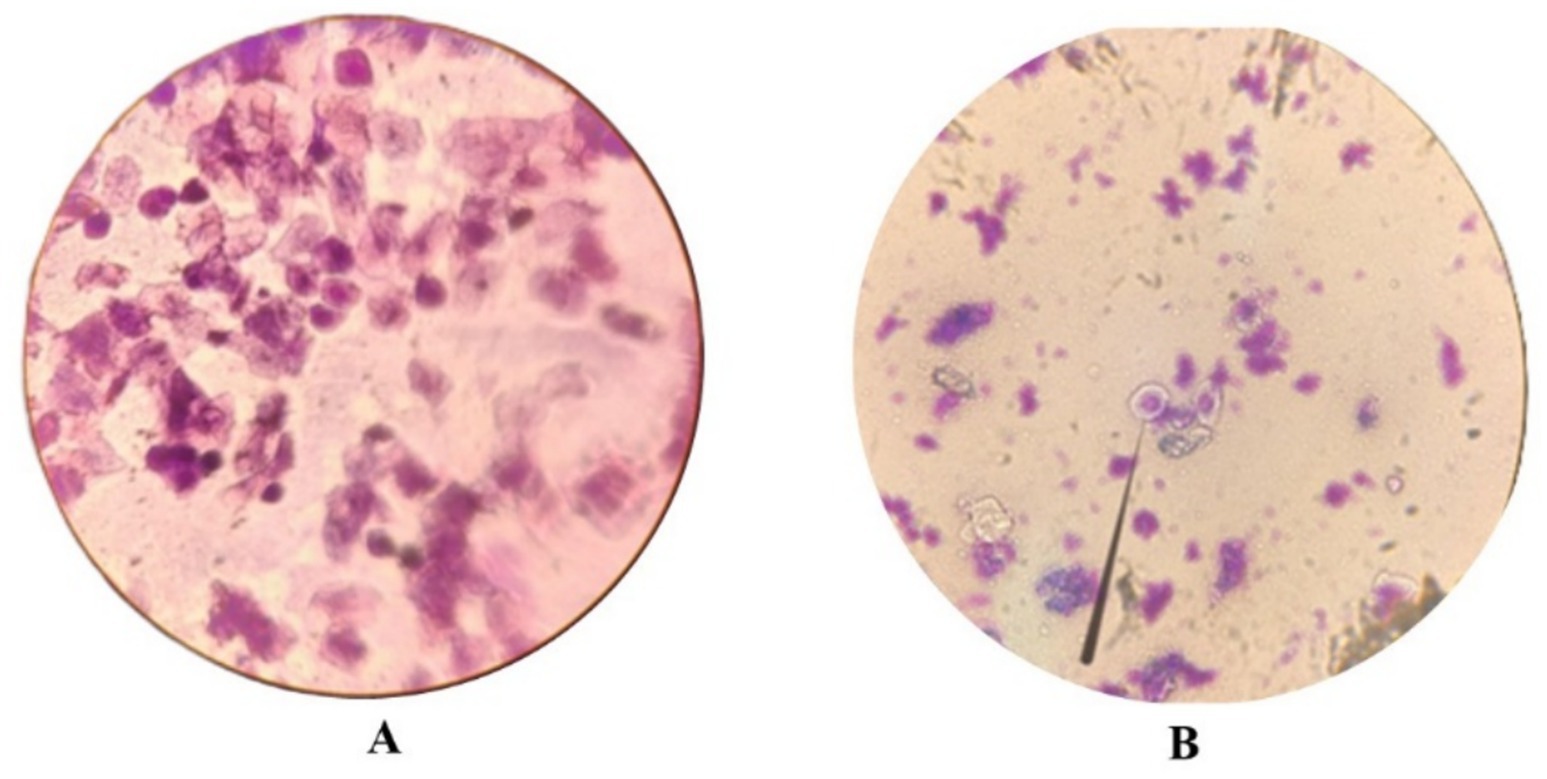 Image showing two circular microscopic views labeled A and B. Image A displays densely packed, dark purple cellular structures on a light pink background. Image B presents a sparser distribution of smaller dark purple cells and features a pointer indicating a specific cell on a lighter background.