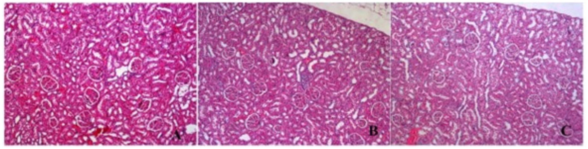Histological comparison of kidney tissues labeled A, B, and C. Each section shows variably dense arrangements of pink and white structures, representing different cellular and tissue patterns under histological examination.