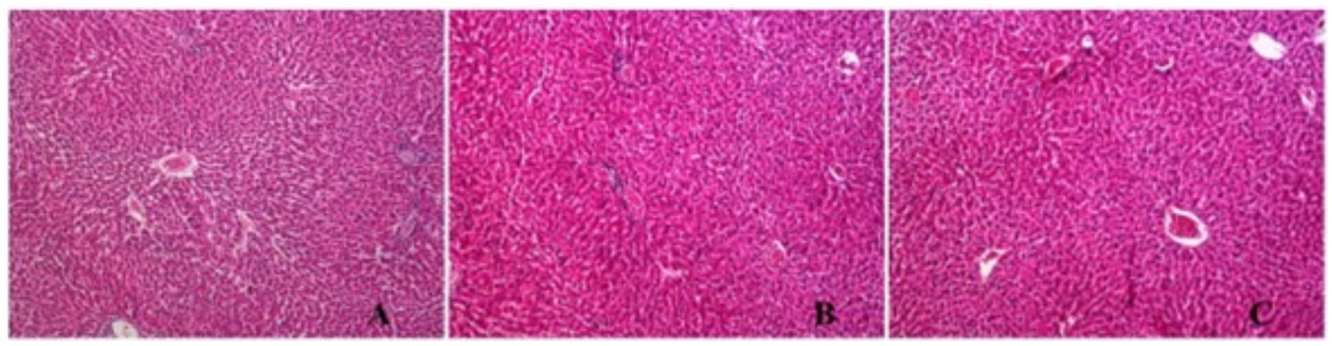 Three microscopic images labeled A, B, and C display liver tissue samples stained in pink. Each shows a dense cellular structure with slight variations in pattern and cell arrangement.