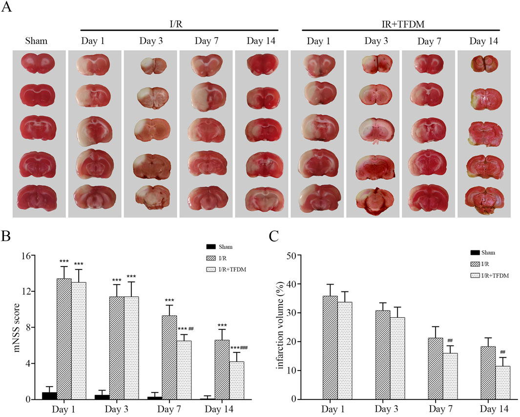 Panel A shows brain sections at different time intervals for Sham, I/R, and I/R+TFDM groups. Panel B depicts a bar graph of mNSS scores over time, indicating statistical differences among the groups. Panel C presents a bar graph of infarction volume percentage, showing significant differences in the treatment effects across time points.