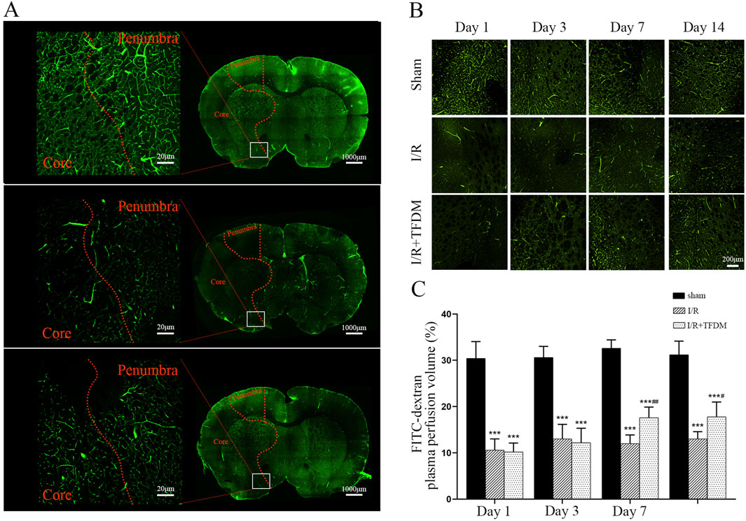 Panel A shows fluorescence microscopy images of brain tissue sections highlighting the penumbra and core areas. Panel B presents fluorescence images over 14 days comparing sham, I/R, and I/R+TFDM treatments. Panel C displays a bar graph of FITC-dextran plasma perfusion volume percentages, comparing the same treatments over four time points. Scale bars are included for reference.