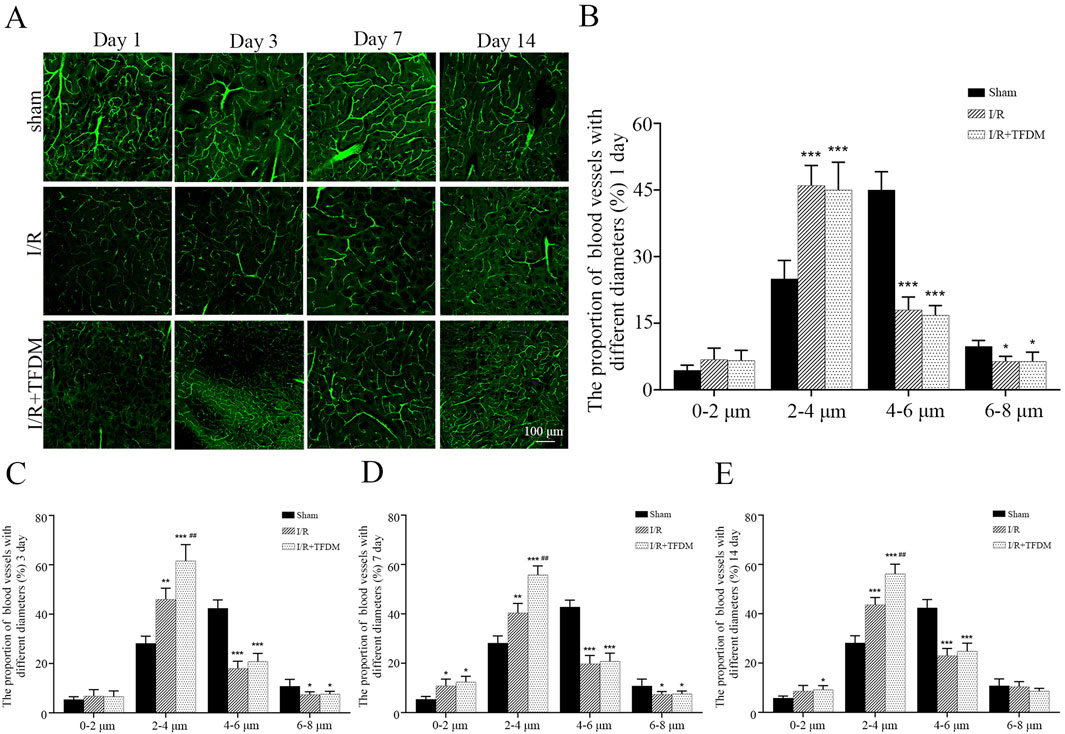 Panel A shows micrographs of blood vessels on days 1, 3, 7, and 14 for sham, I/R, and I/R + TFDM groups. Panels B to E present bar graphs of blood vessel proportions across sizes and days, with variations in response to treatments. The scale bar indicates 100 micrometers.