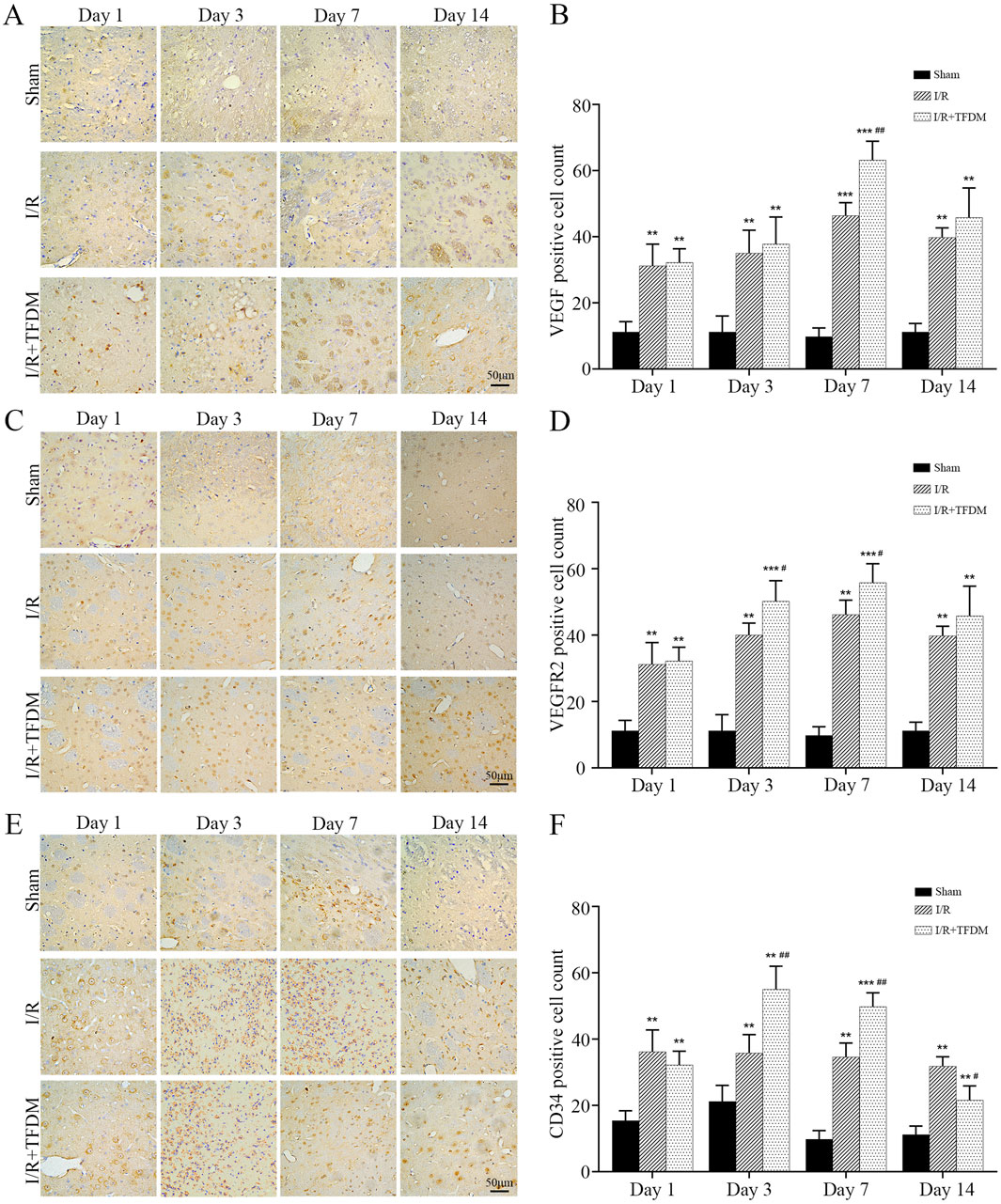 Histological images and bar graphs show the effects of treatments over 14 days. Panels A, C, and E display microscopic images of tissue sections under Sham, I/R, and I/R+TFDM conditions for Days 1, 3, 7, and 14. Panels B, D, and F show corresponding bar graphs for positive cell counts of VEGF, VEGFR2, and CD34. The graphs indicate significant differences over time and between treatment groups, as represented by statistical markers.