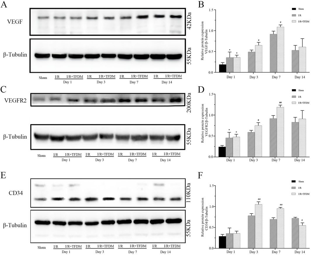 Western blot and bar graph analysis of protein expression over different days. Panels A and B show VEGF expression, C and D show VEGFR2, and E and F show CD34. Each panel includes a Western blot image with corresponding β-Tubulin as a loading control, alongside a bar graph displaying relative protein expression levels. Comparisons are made between Sham, I/R, and I/R+TFDM groups across days one, three, seven, and fourteen. Significant differences are marked with symbols.