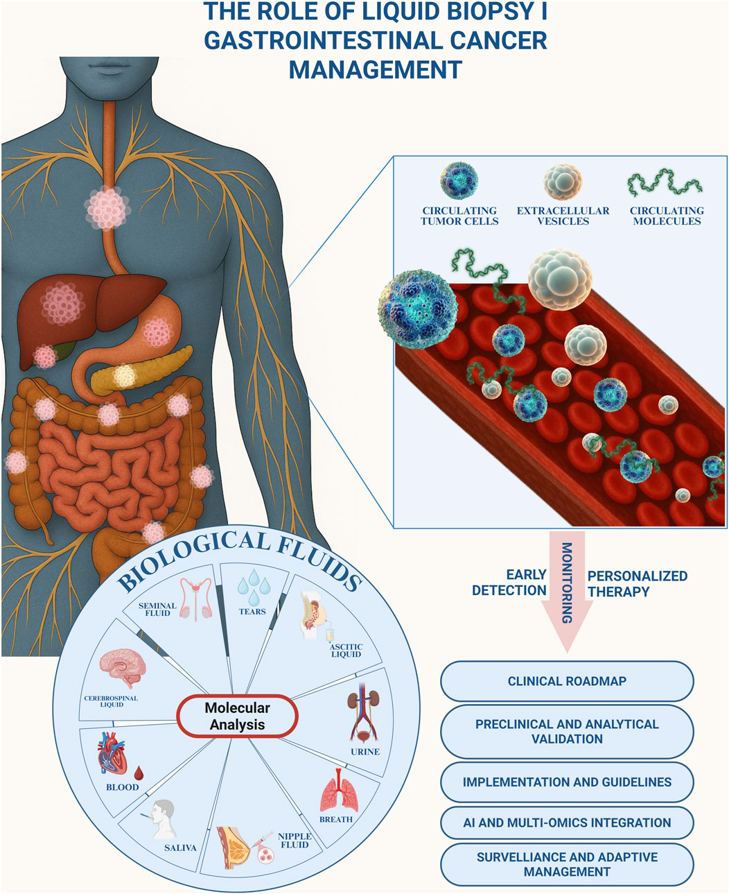 Diagram illustrating the role of liquid biopsy in gastrointestinal cancer management. A human silhouette highlights internal organs with cancerous lesions. Inset shows blood vessels with circulating tumor cells, extracellular vesicles, and molecules. A circular graphic labeled