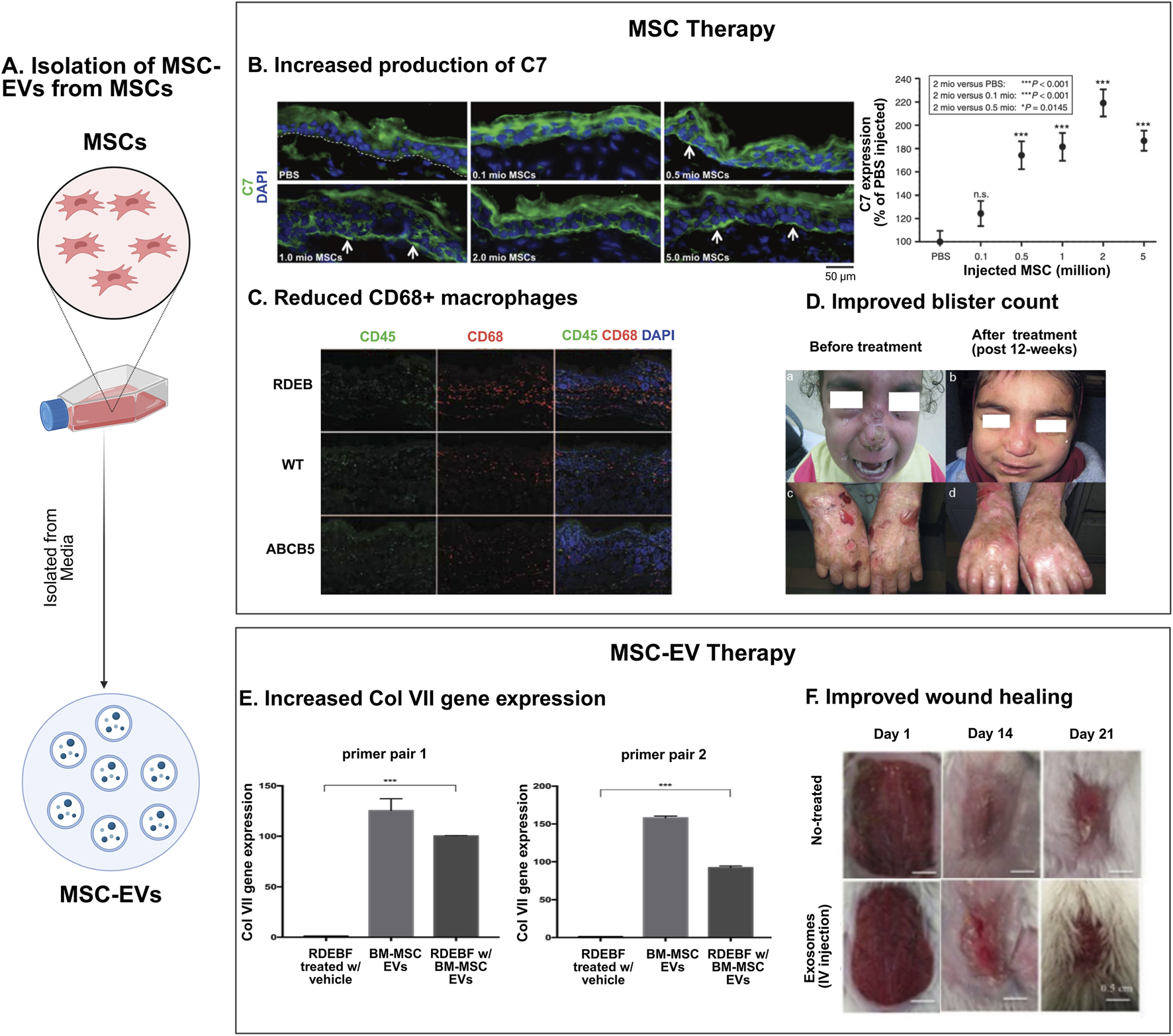 Diagram detailing MSC therapy effects on blister count and gene expression: A. Shows MSC-EVs isolation from MSCs. B. Images display increased C7 production across five MSC doses; graph shows significant C7 expression increase at higher doses. C. Immunofluorescence images show reduced CD68+ macrophages in RDEB, WT, and ABCB5 conditions. D. Photographs demonstrate improved appearance of blisters before and 12 weeks after treatment. E. Bar graphs indicate increased Col VII gene expression with BM-MSC EVs for two primer pairs. F. Wound healing images show progression from day 1 to day 21 with exosome injection improving healing.
