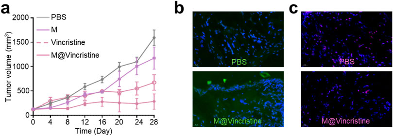 Graph and two sets of microscopy images. The graph (a) shows tumor volume over 28 days for four treatments: PBS, M, Vincristine, and M@Vincristine. Tumor volume is highest with PBS and lowest with M@Vincristine. Microscopy images (b) and (c) compare PBS and M@Vincristine treatments, showing blue and pink stained cells, indicating different cellular effects.