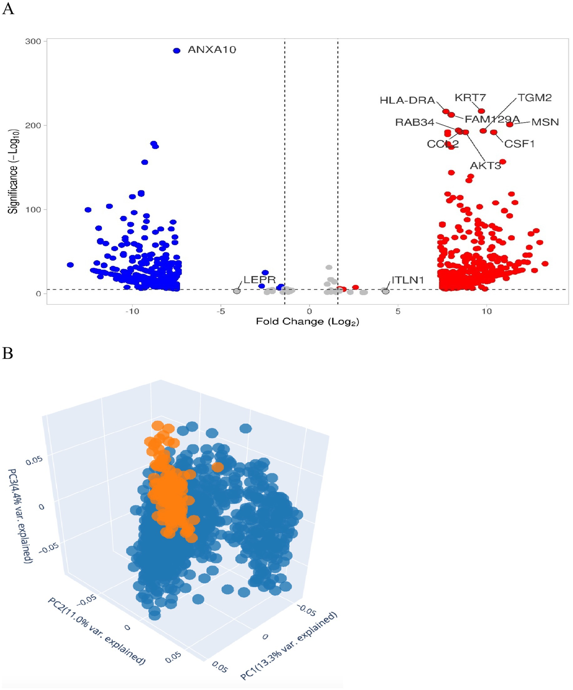 Panel A shows a volcano plot with log2 fold change on the x-axis and significance levels on the y-axis, highlighting significant genes such as ANXA10, LEPR, KRT7, and AKT3. Panel B is a 3D scatter plot of principal component analysis with PC1, PC2, and PC3 axes, displaying clusters in blue and orange, indicating variance explained.