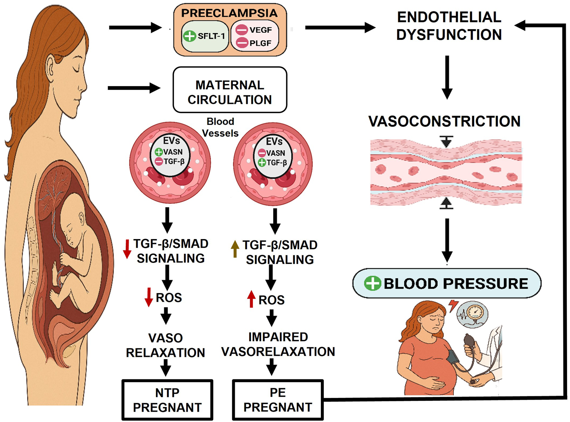 Illustration depicting the process of preeclampsia in pregnancy. On the left, a pregnant woman and fetus are shown. Preeclampsia affects maternal circulation, leading to endothelial dysfunction and vasoconstriction. This process is highlighted with two blood vessel diagrams, representing normal and impaired signaling. Decreased TGF-β/SMAD signaling and reactive oxygen species (ROS) activity lead to vasorelaxation problems in preeclamptic pregnancies, marked as NTP and PE pregnant. The right section shows increased blood pressure measured in a pregnant woman, emphasizing the condition's impact.