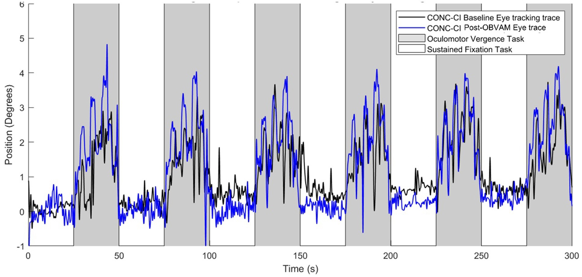 Graph showing eye tracking data over time in seconds, with position in degrees on the y-axis. Black represents baseline eye tracking, and blue represents post-OBVAM eye tracking. Grey sections indicate oculomotor vergence tasks, and white sections represent sustained fixation tasks. Peaks occur in grey sections, with fluctuations throughout.