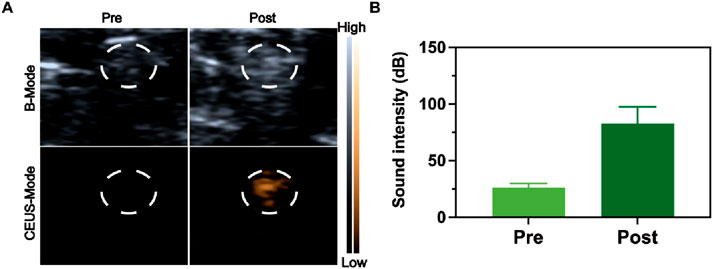 Panel A shows two ultrasound images comparing pre and post conditions in both B-Mode and CEUS-Mode, with enhanced visibility in post-CEUS-Mode. Panel B is a bar chart showing increased sound intensity in dB for pre and post conditions, with post having a higher value.