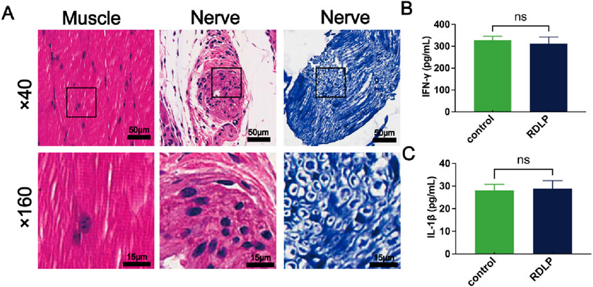 Histological and bar chart images showing muscle and nerve sections and cytokine levels. Panel A: muscle and nerve tissues stained, with views at forty and one hundred sixty times magnification. Panels B and C: bar charts for IFN-γ and IL-1β levels, comparing control and RDLP groups. Non-significant differences are noted.