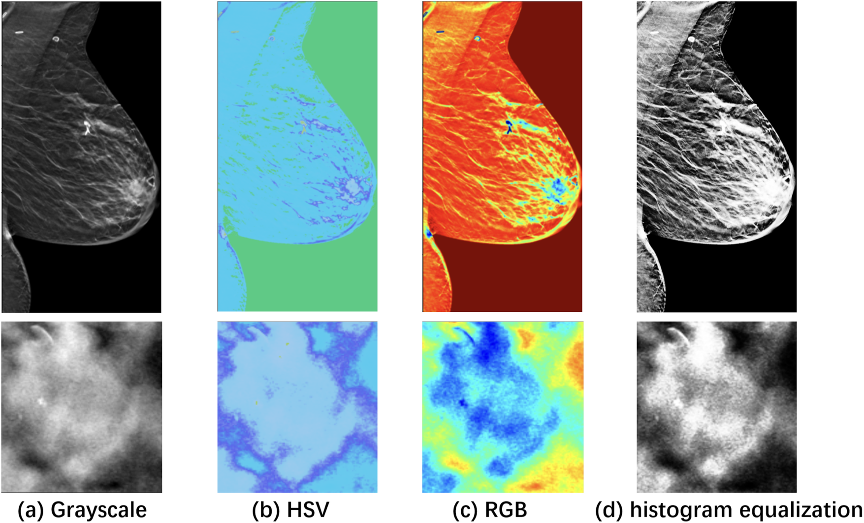 Visualization of a specific case with the ROI zoomed in. (a) Grayscale raw image; (b) Pseudo-color enhanced image in HSV; (c) Image transformed back to RGB after enhancement. (d) Raw image after histogram equalization, shown as a reference.