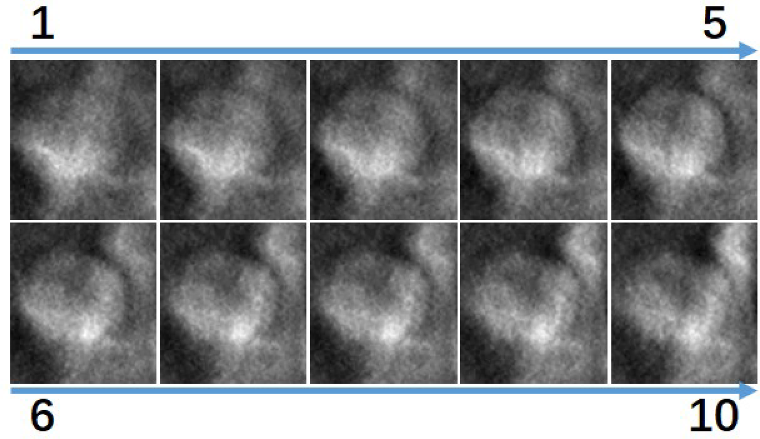 A grid of ten grayscale microscopic images, arranged in two rows of five. Each image depicts a cloudy, textured, and circular structure. Numbering from one to ten, arrows indicate the sequence across the rows.