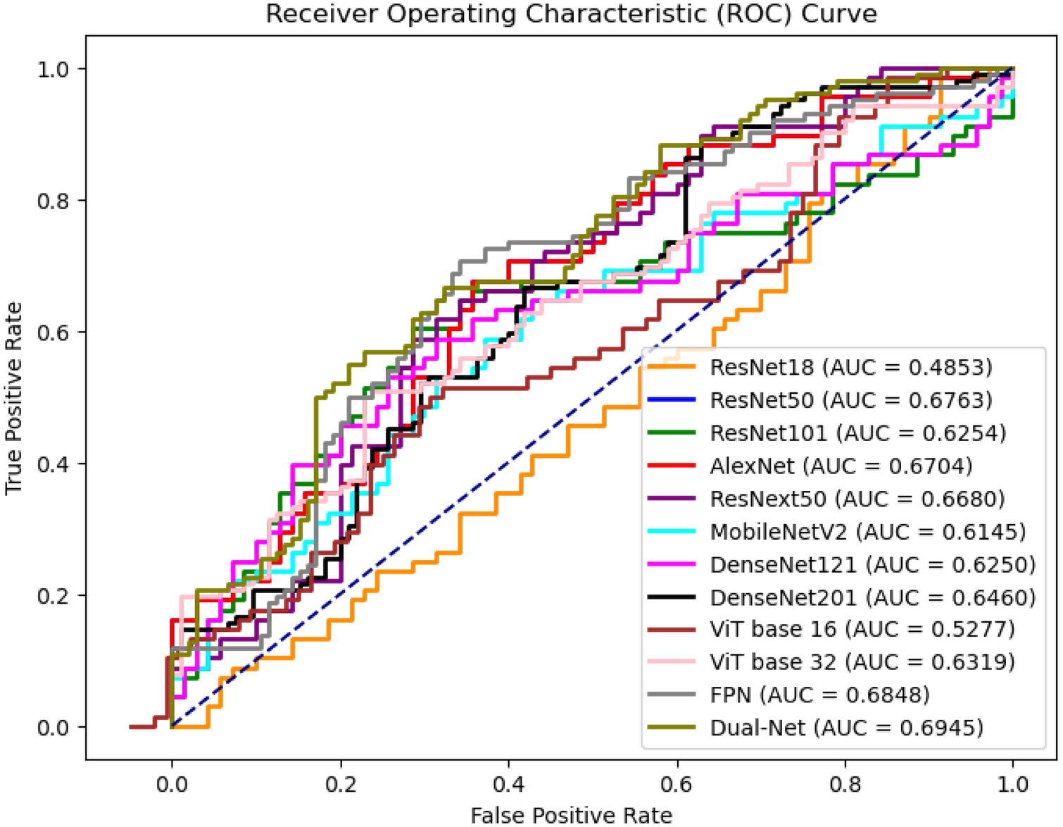 Receiver Operating Characteristic (ROC) curve showing true positive rate versus false positive rate for various models. The legend lists models with their respective Area Under the Curve (AUC) values: ResNet18 (0.4853), ResNet50 (0.6763), ResNet101 (0.6254), AlexNet (0.6704), ResNext50 (0.6680), MobileNetV2 (0.6145), DenseNet121 (0.6250), DenseNet201 (0.6460), ViT base 16 (0.5277), ViT base 32 (0.6319), FPN (0.6848), Dual-Net (0.6945). A diagonal dashed line represents random guessing.