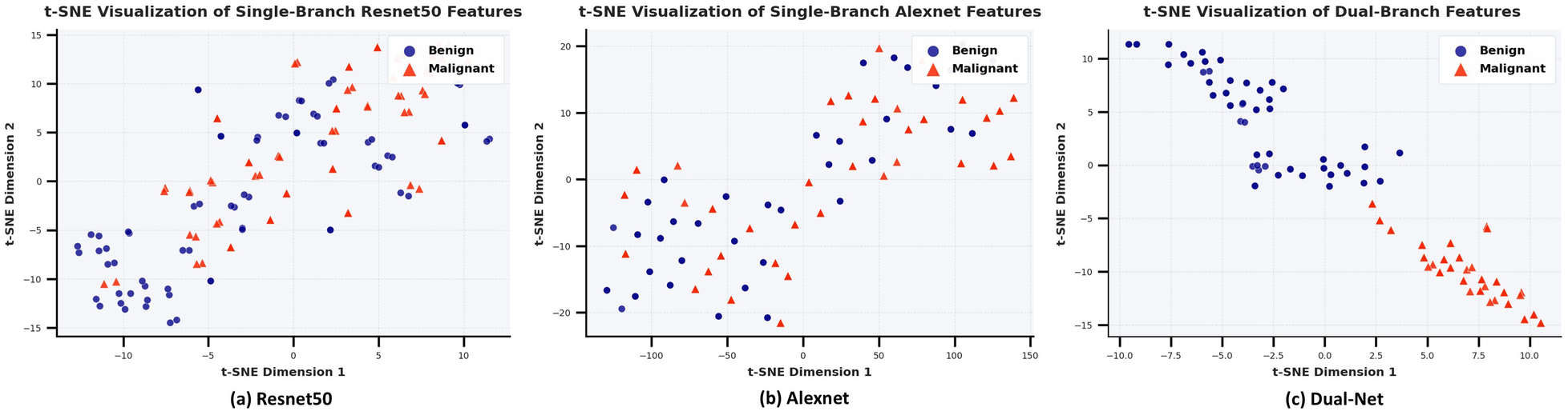 Three scatter plots illustrate t-SNE visualizations of tumor classifications. (a) Resnet50: Features show separation between benign (blue circles) and malignant (red triangles). (b) Alexnet: Similar separation with varied spreading. (c) Dual-Net: Clear distinction with more compact clustering of benign and malignant features.